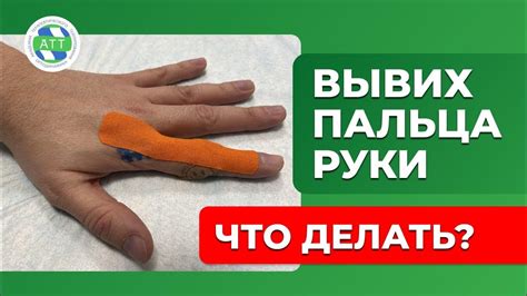 Советы при повреждении пальца в парной
