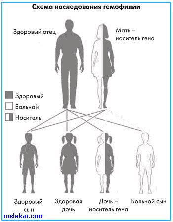 Современные методы диагностики гемофилии