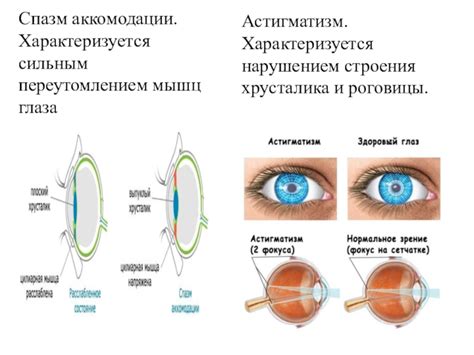 Современный образ жизни и риск развития нарушения аккомодации глаза