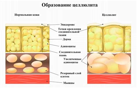 Содержание добавок, способствующих развитию целлюлита