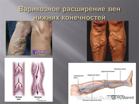 Сонник: эмоциональные интерпретации згнонительных высыпаний на нижних конечностях