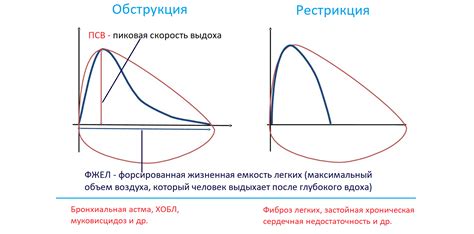 Спирометрия: классический метод измерения объема легких