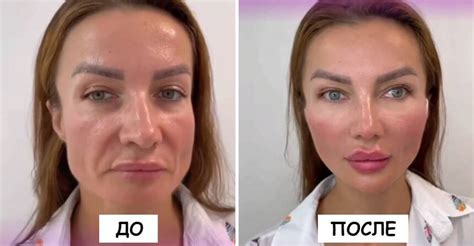 Споры вокруг обновленного лица