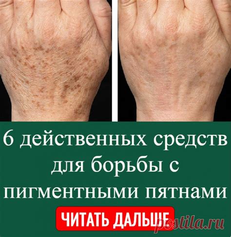 Тактика борьбы с коричневыми пятнами