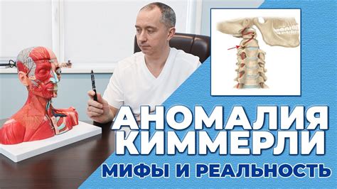 Техники массажа при аномалии Киммерли
