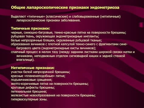 Типичные признаки заболевания