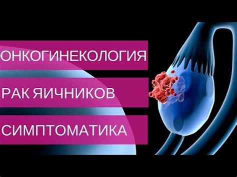 Типы опухолей: различия и проявления