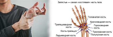 Типы шишек на сгибе руки