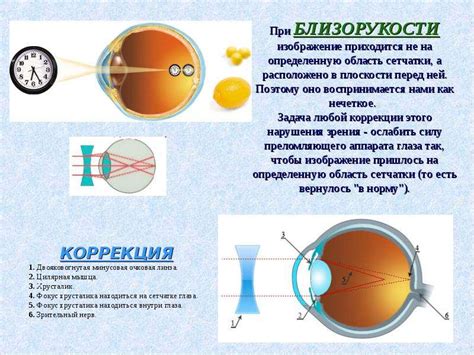 Трихромные нарушения цветового зрения и их особенности