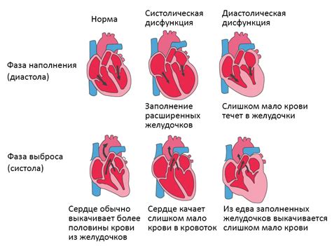 Турбина: признаки проблем и возможные последствия