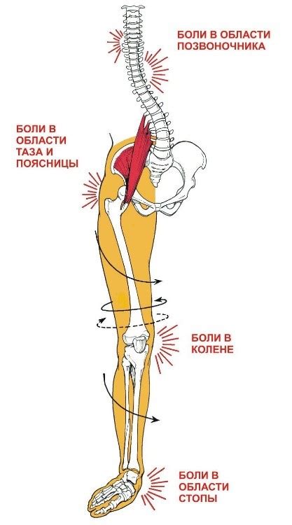 Тянущая боль в паху у женщин