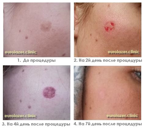 Удаление пятен на пуфах