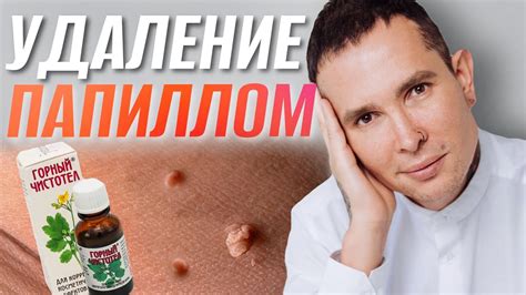 Удаление с помощью уксуса