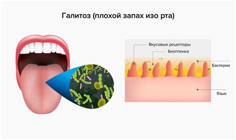 Употребление некоторых продуктов и запах гуаши изо рта