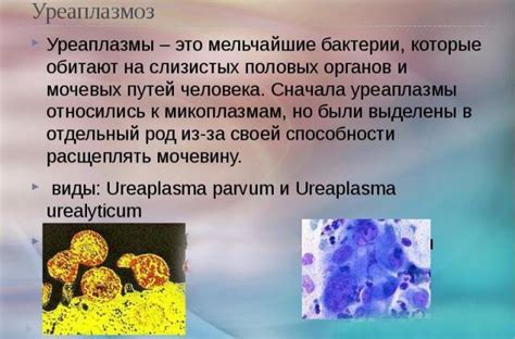 Уреаплазма уреалитикум: лечение и профилактика заболевания