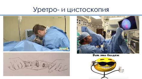 Уретроскопия: осмотр мочеиспускательного канала