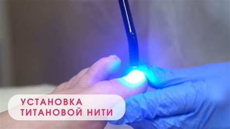 Установка напряжения нити