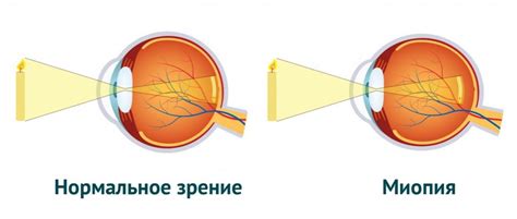 Ухудшение функции зрения: как вода в бассейне может повлиять на глаза