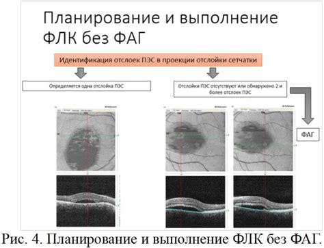 ФЛК: суть и назначение