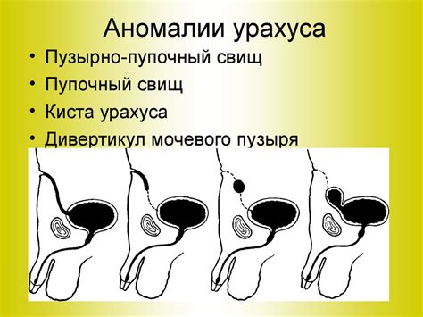 Физиологические предпосылки для образования влажности в области пупка у взрослых