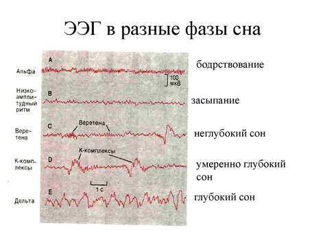 Физиологические причины непроизвольного движения у собак во время сна