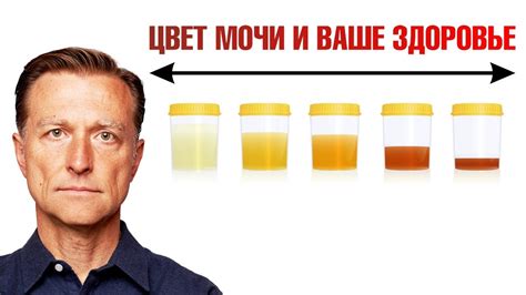 Физиологические факторы, влияющие на цвет мочи