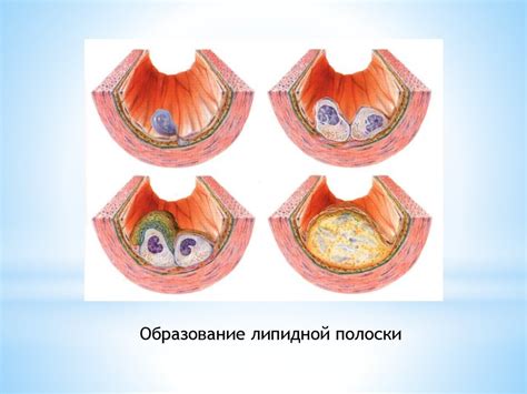 Физическая активность и нарушение липидного обмена