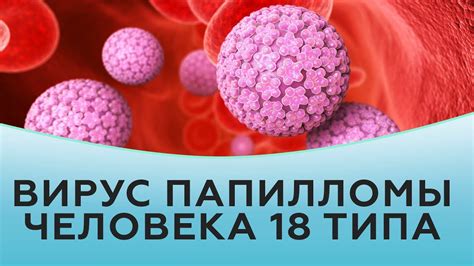 Физические методы борьбы с вирусом папилломы человека типа 66 у женщин