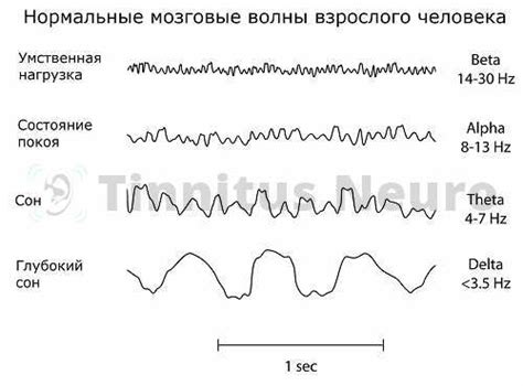 Фиксация волн