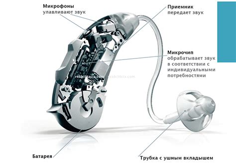 Финансовая поддержка для ремонта слухового аппарата