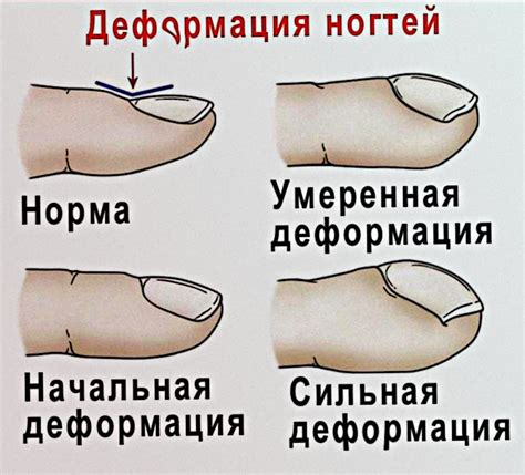 Функция белых штучек