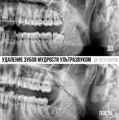 Чистка пола: основные методы удаления иголок