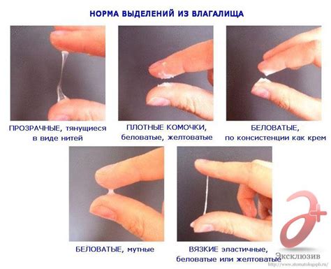 Что делать при появлении желтых выделений