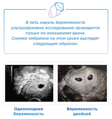 Что происходит с животом во время беременности