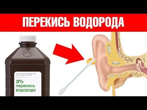 Шаги процедуры очистки ушей питомцу с использованием перекиси водорода