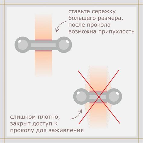 Швы после прокола