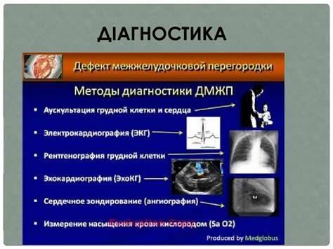 ЭКГ: основной метод диагностики заболеваний сердца