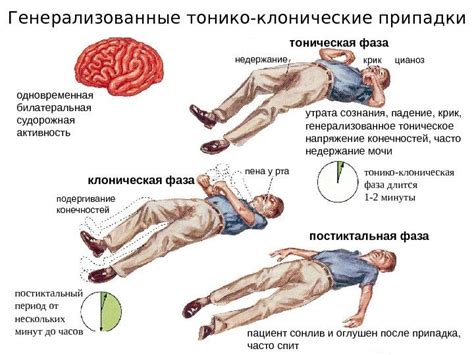 Эпилепсия и лечение: современные методы