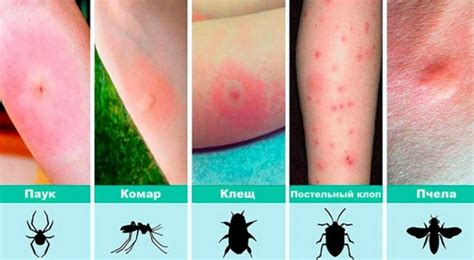 Эффективные методы облегчения зуда после укуса насекомого в веко