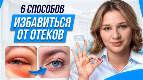 Эффективные методы устранения отеков