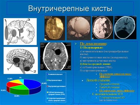  Арахноидальная киста в голове: основные характеристики и причины возникновения 