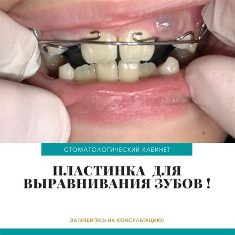  Неправильное развитие костей 