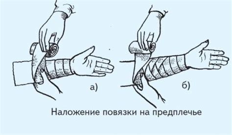  Подготовка к процедуре на сокрытых сосках: необходимые шаги 