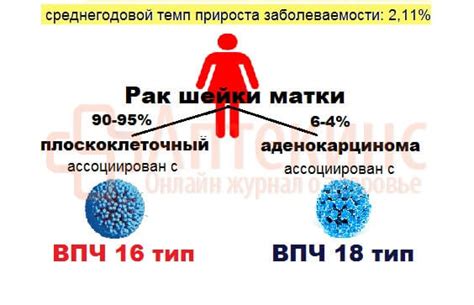  Превентивные меры: эффективные способы предотвратить передачу ВПЧ 16 